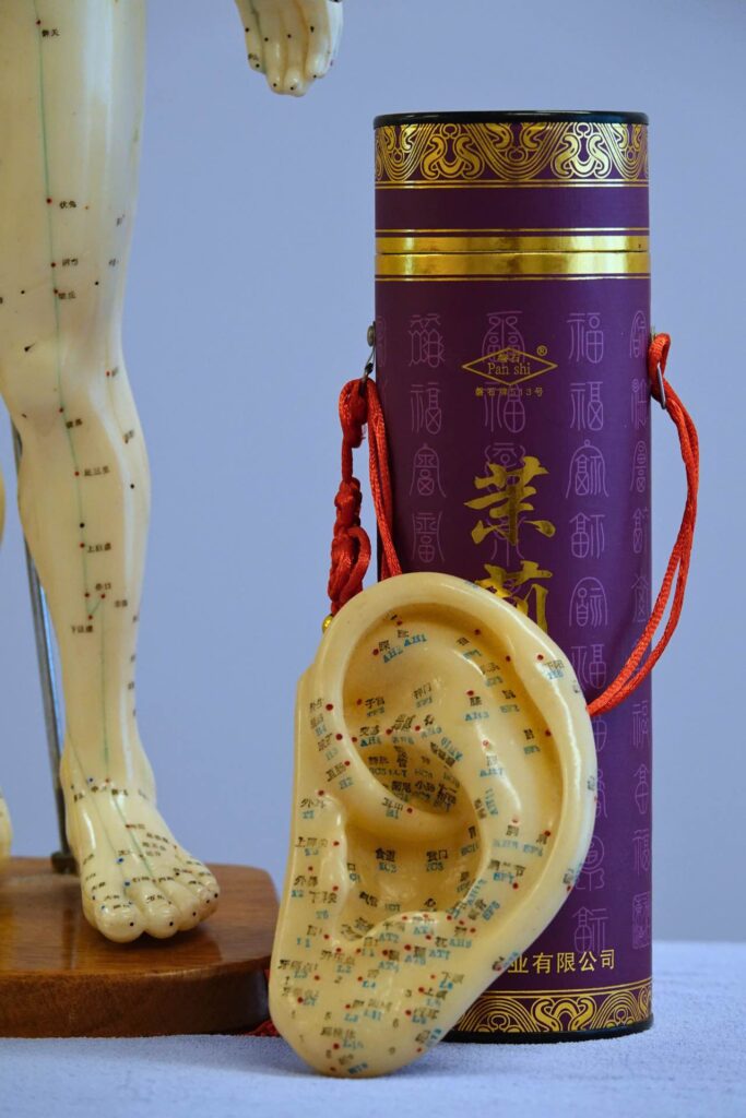 Acupunctuur uitgelegd bij Praktijk voor acupunctuur in Den Haag